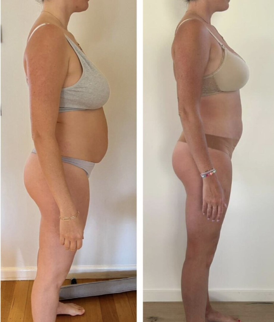 Emily, before and after
